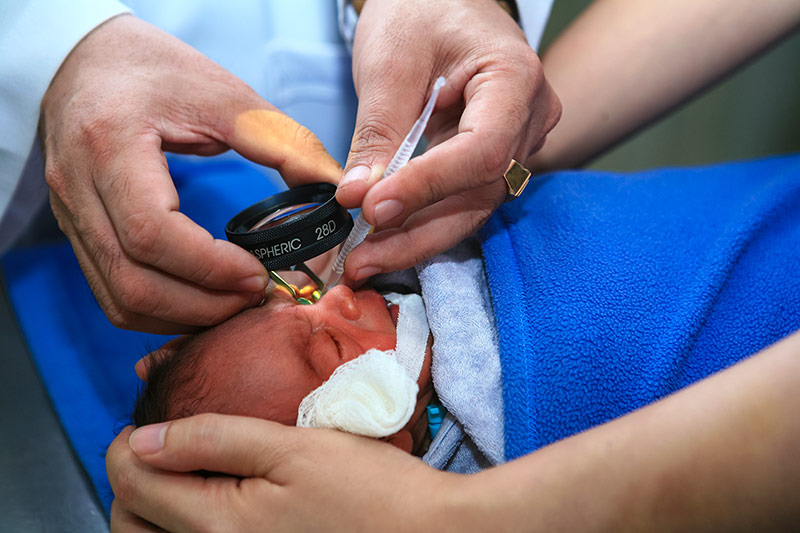Ophthalmology Equipment for Premature Retinopathy Screening
